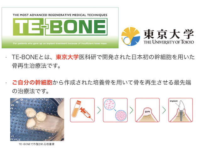 TE-BONEとは、東京大学医科研で開発された日本初の幹細胞を用いた骨再生治療法です。ご自分の幹細胞から作成された培養骨を用いて骨を再生させる最先端の治療法です。